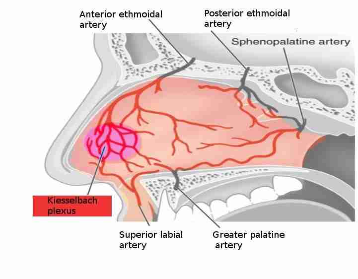 EPISTAXIS - Figure 1.0